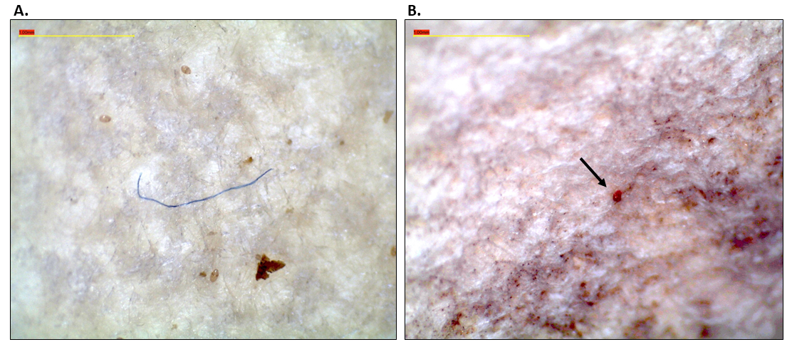 Figure 1. Photographs of representative microplastics found in the GI tracts of raptors from California’s central coast region, taken via a dissecting scope at 30x magnification. A) a blue microfiber; B) a cluster of microbeads (arrow added for clarity). Scale bar (yellow) = 1 mm.