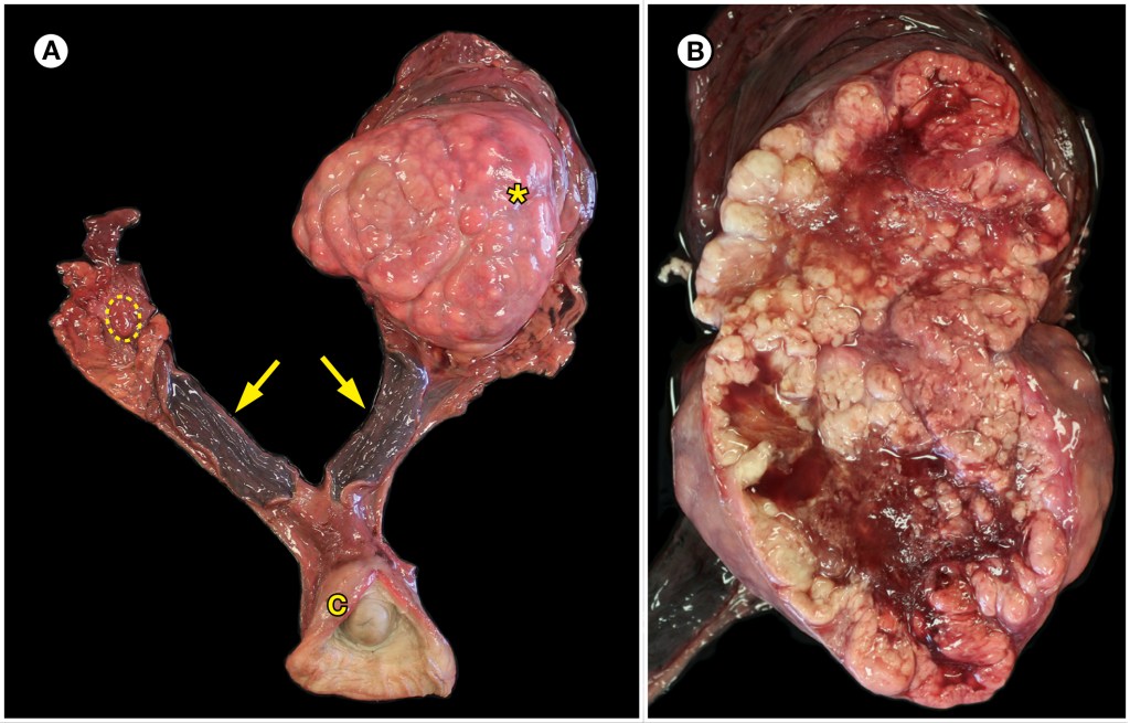 Two images of ovarian granulosa cell tumor in a southern sea otter. Left shows reproductive tract, noting large mass on left ovary. Right image shows cut surface of left ovary.