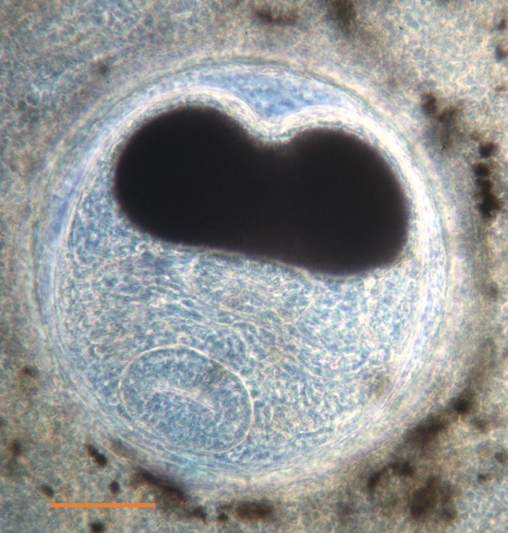 Presumptive Nanophyetus salmincola metacercaria in juvenile Trinity River Chinook Salmon kidney squash preparation viewed by 400x phase contrast microscopy, note the dark excretory vesicle (bar = 100µm).